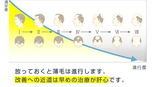 現在のあなたの頭髪はどのタイプ？